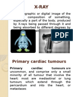 X-Ray Findings of Common Bone and Soft Tissue Injuries (39