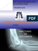 Fracturas del olécranon