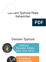 Demam Typhoid Pada Kehamilan