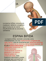 Espina Bifida Ibai