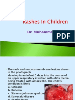 Rashes in Children by Dr. Muhammad - Rashid