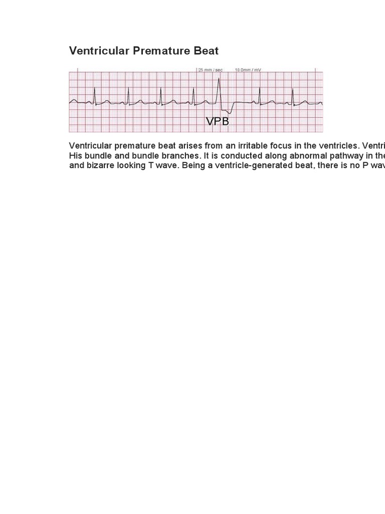 Ventricular Premature Beat Explained | PDF