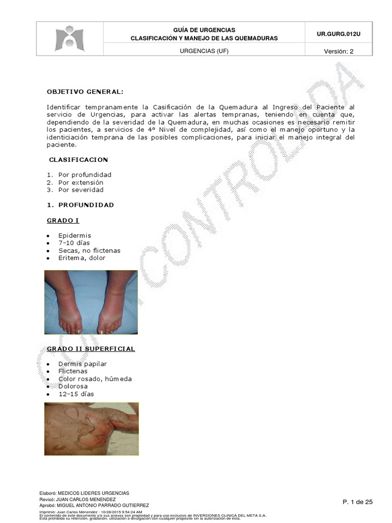 Clasificación y Manejo de Quemaduras | PDF | Quemar | Herida
