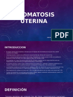 Miomatosis Uterina