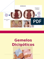 Defectos en La Formación de Gemelos (Embriologia)