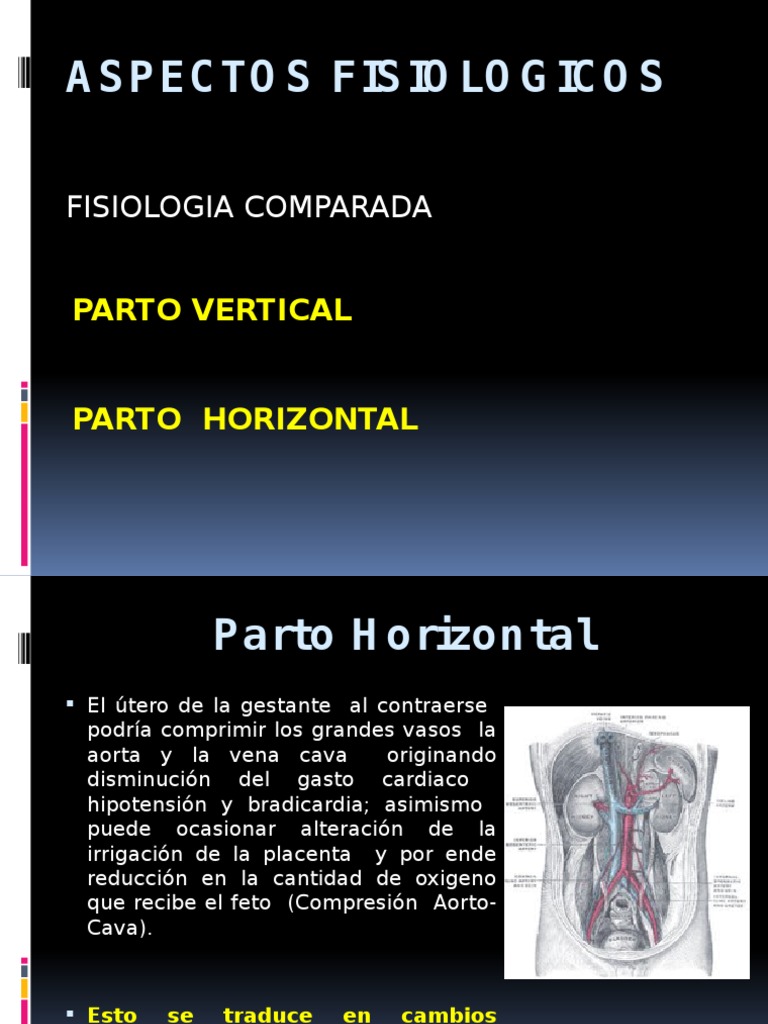 Ponencia de Parto Vertical | PDF | Feto | Parto