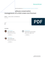 MultiDisciplinary Conservative Management of A Vital Crown Fracture