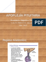 Presentación - APOPLEJÍA PITUITARIA