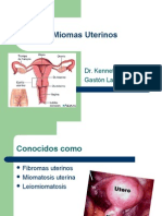 miomas_uterinos