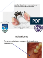 Protesis Parcial Removible