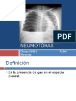 Neumotorax San Blas