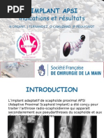 L'implant APSI