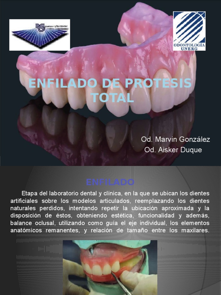 Enfilado de Dientes en Prótesis Total | PDF | Anatomia dental | Boca