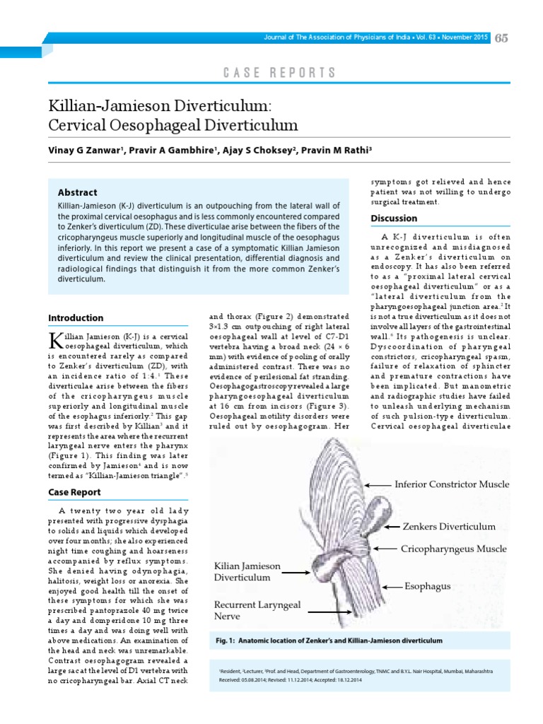 10 CR Killian Jamieson Diverticulum PDF Esophagus Medicine
