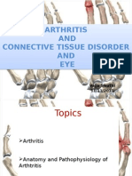Arthritis AND Connective Tissue Disorder AND EYE