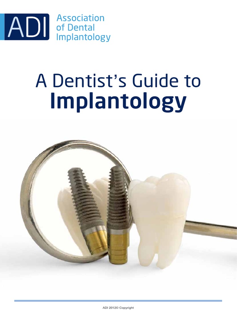 A Dentists Guide To Implantology PDF | PDF | Dental Implant | Dentistry