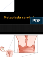 Metaplasia Cervical