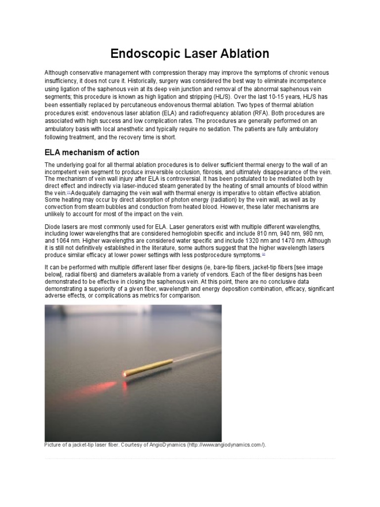 Endoscopic Laser Ablation ELA Mechanism of Action PDF Ablation Vein