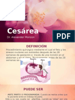 Cesárea