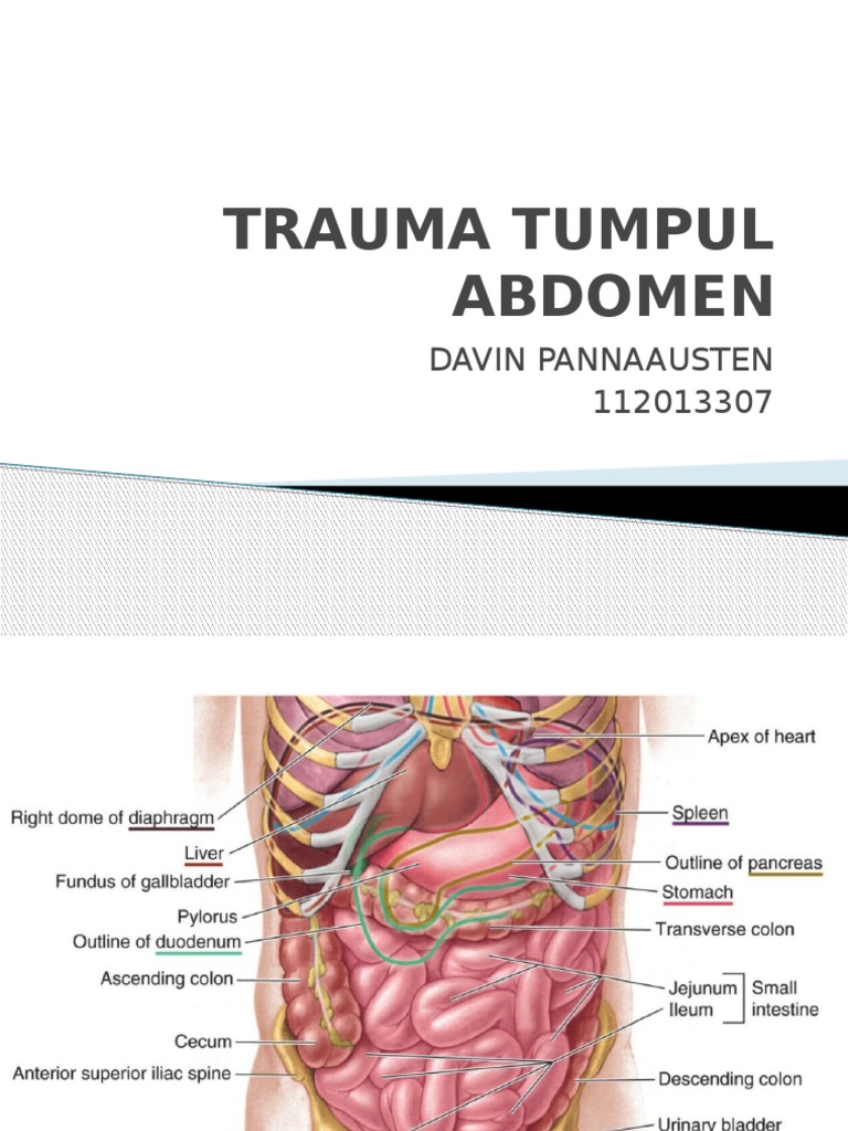 Penanganan Trauma Tumpul Abdomen | PDF