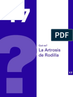 Artrosis de Rodilla