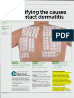 Identifying The Cause of Contact Dermatitis