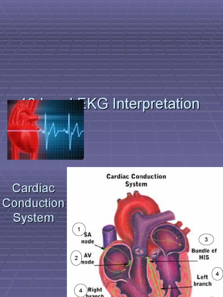 12 Lead EKG Interpretation Guide | PDF | Electrocardiography | Visual ...