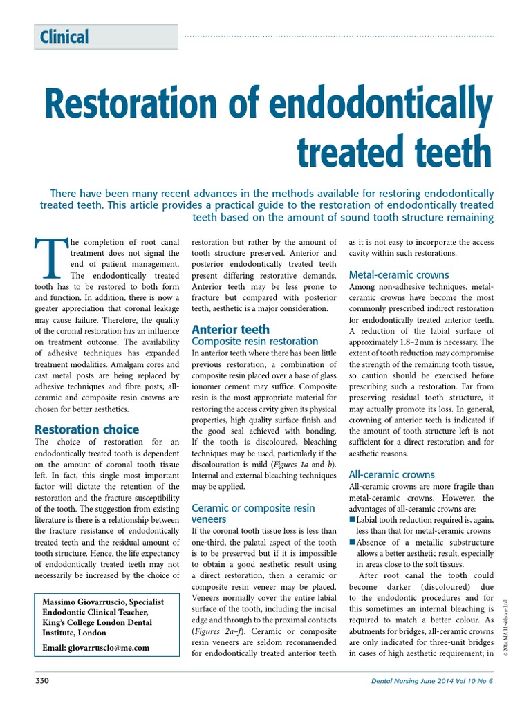 Restoration of Endodontically Treated Teeth | PDF | Dental Composite ...