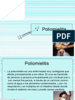 Poliomielitis 