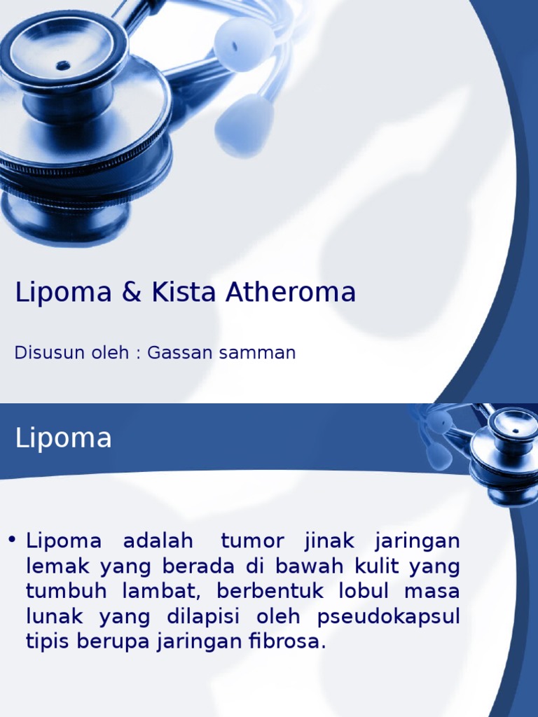 Ateroma Merupakan  Penyebab Tandatanda Pengobatan Dan Pencegahan