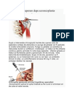 Protocol de Recuperare Dupa Acromioplastie