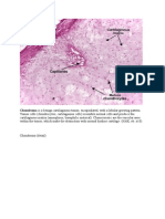 Chondroma Is A Benign Cartilaginous Tumor