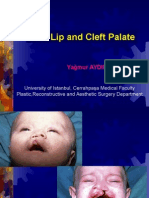 Cleft and Palate