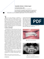 Atypical Chairside Immediate Impression