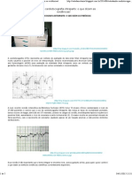 Estudando Cardiotocografia Intraparto - o Que Dizem As Evidências!