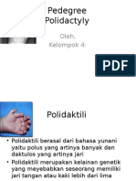 Polidaktili