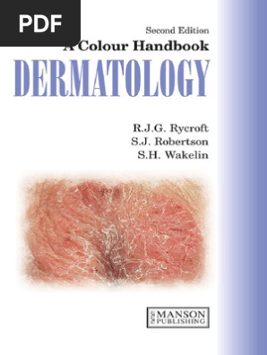 A Colour Handbook Of Dermatology 2nd Ed R Rycroft Et Al