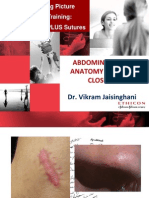 Abdominal Wall Anatomy & Fascia Closure - Sept