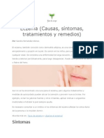 Eczema (Causas, síntomas, tratamientos y remedios)