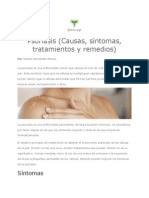 Psoriasis (Causas, síntomas, tratamientos y remedios)