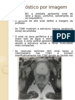 Diagnóstico Por Imagem Próstata Power Point