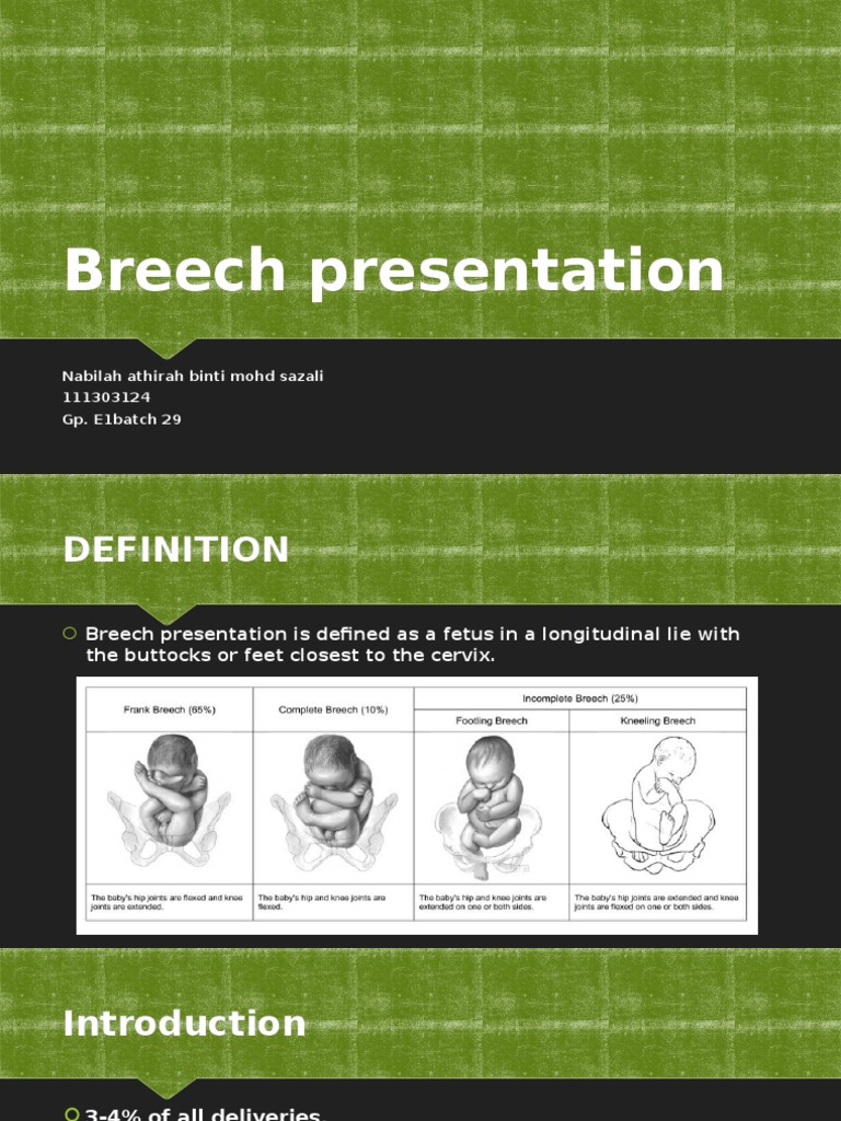 section for breech presentation