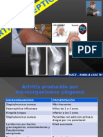 Artritis Septica 