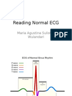 Reading Normal ECG - Maria A.S.W