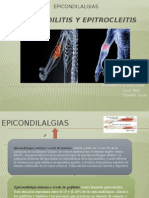 Epicondilitis y Epitrocleitis 