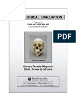 Human Hispanic Female Skull With Down Syndrom