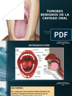 Tumores Benignos de La Cavidad Oral