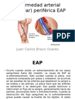 Enfermedad Arterial (Vascular) Periférica EAP