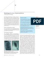 Pneumothorax Radiologic Review