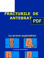 Fracturi de Antebrat 